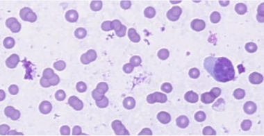 lymphocytes