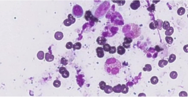 eosinophils